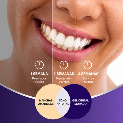 WHITESMILE ESPUMA MORADA DE DIENTES